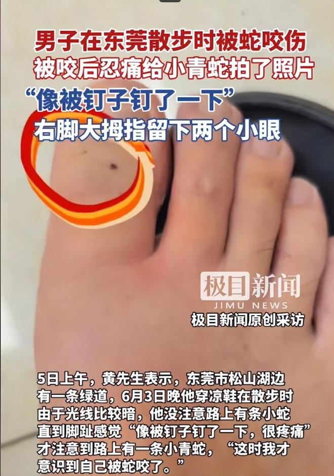 九游会J9平台：广东男子散步被毒蛇咬伤淡定拍照去医院网友：三亚女孩死真冤(图3)