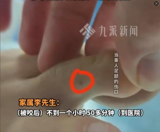 九游会J9平台：广东男子散步被毒蛇咬伤淡定拍照去医院网友：三亚女孩死真冤(图7)