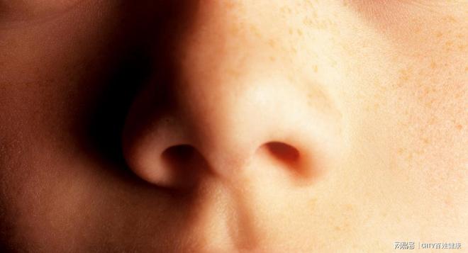 爱挖鼻孔的人更容易老年痴呆？从爱鼻日开始改掉这些坏怀习惯！(图1)